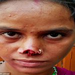 Man cuts off wife’s nose, runs away with it over dowry OrijoReporter.com, dowry in india