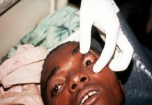 LASUTH wants Nigerians to donate eyes at deaths OrijoReporter.com, LASUTH