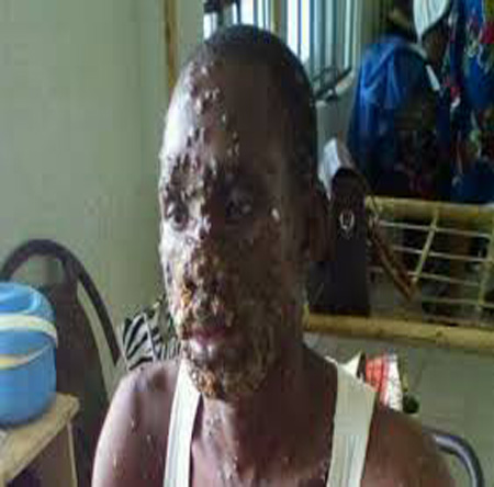 Army denies infecting Igbos with monkeypox virus