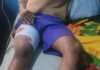 AFTER BOY WAS SHOT AT APC RALLY: Police Detain Osun Commissioner, Adeleke’s Camp Cries Foul