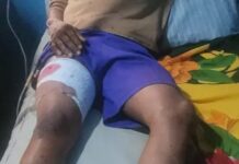 AFTER BOY WAS SHOT AT APC RALLY: Police Detain Osun Commissioner, Adeleke’s Camp Cries Foul