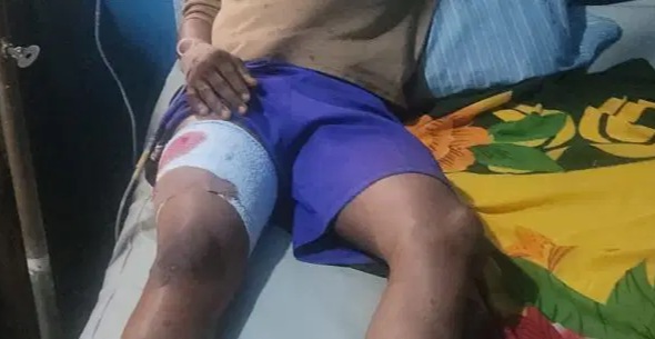 AFTER BOY WAS SHOT AT APC RALLY: Police Detain Osun Commissioner, Adeleke’s Camp Cries Foul